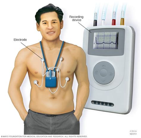 wearing a heart monitor for 2 weeks